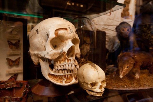 Human skull and bones once used as medical specimens for teaching anatomy. Most have been collected from medical schools clearing out their archives.